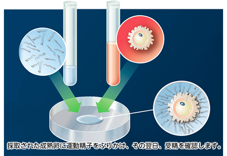 ウィメンズクリニック本町｜体外受精・顕微授精
